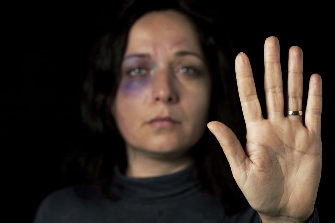 Woman with bruised face raises hand, symbolizing a call to stop domestic violence.